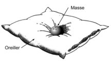 Repr&eacute;sente une boule de quille dans un oreiller  (5 687 octets)